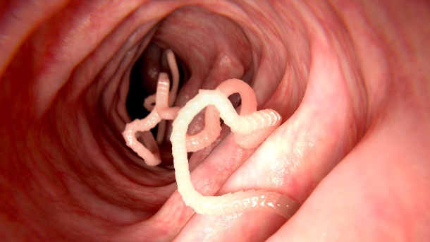 Worms in the gut: Different types of worm infestations